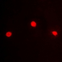 Anti-ZFP95 Antibody