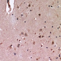 Anti-Cadherin 20 Antibody