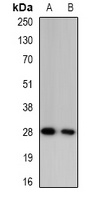 Granzyme A Rabbit Polyclonal Antibody