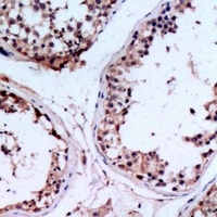 Anti-CHST9 Antibody