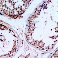 CHST9 antibody