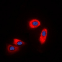 Anti-CHST9 Antibody