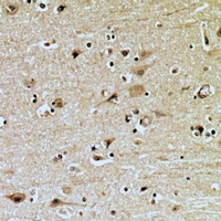 Anti-ZNRF2 Antibody
