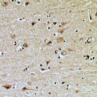 ZNRF2 antibody