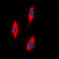 Anti-ZNRF2 Antibody