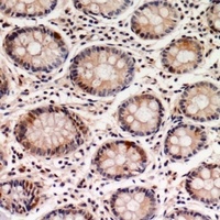 GTPBP2 Rabbit Polyclonal Antibody