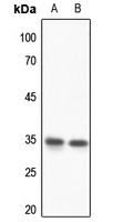 HOXD13 Antibody