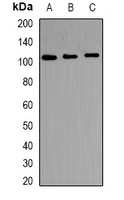 TRAK2 Antibody