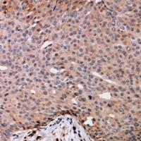 TRAK2 Antibody
