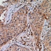 Anti-UBE2G1 Antibody