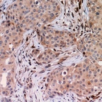 Anti-USP6NL Antibody