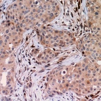 USP6NL antibody