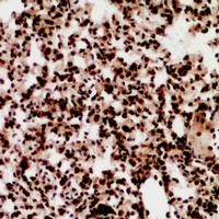 ZNF600 antibody