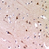 Anti-ZP2 Antibody