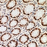 Anti-ZNF839 Antibody