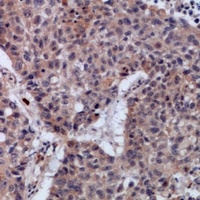 SETMAR antibody