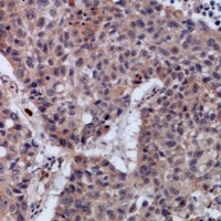 Anti-SETMAR Antibody