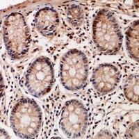 Anti-TSSK6 Antibody