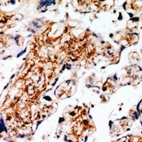 RLK Antibody