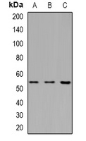 Ku70 (Acetyl-K338) Rabbit Polyclonal Antibody