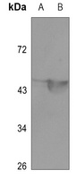 MEF2A (Acetyl-K403) Antibody