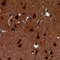 Alpha-synuclein (Phospho-Y125) Antibody
