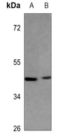 IDH3 gamma Rabbit Polyclonal Antibody