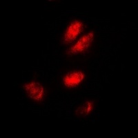 Anti-ASF1A Antibody
