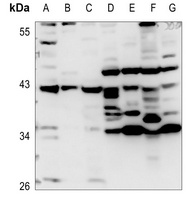 Apolipoprotein A5 Rabbit Polyclonal Antibody