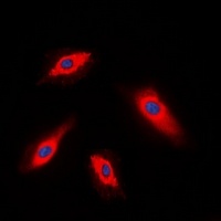 Anti-ALPK1 Antibody