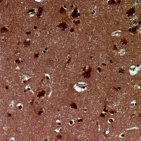 Anti-EID1 Antibody