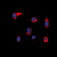 PIKFYVE antibody