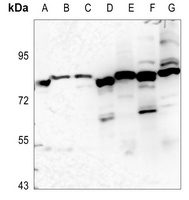 EPS8L1 Antibody