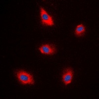 EPS8L1 antibody