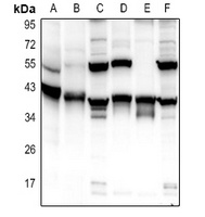 Carbonic Anhydrase 13 Rabbit Polyclonal Antibody