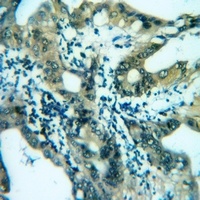 Anti-Carbonic Anhydrase 13 Antibody