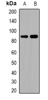 ADAM32 Rabbit Polyclonal Antibody