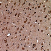 Anti-AAK1 Antibody