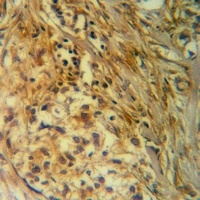 Anti-ITPK1 Antibody