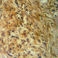 ITPK1 antibody