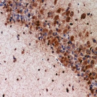 CDH6 antibody