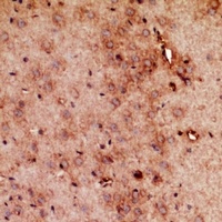 Anti-RRP7A/B Antibody