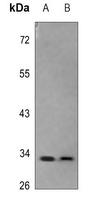 SCP3 Rabbit Polyclonal Antibody