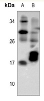 TCL-1A Rabbit Polyclonal Antibody
