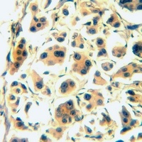 Anti-CD126 Antibody