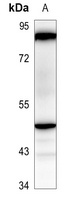 IKK gamma Rabbit Polyclonal Antibody