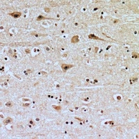 IKK gamma Rabbit Polyclonal Antibody