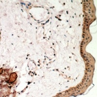 Anti-Desmoglein 1 Antibody