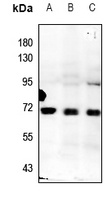 ZNF307 Rabbit Polyclonal Antibody