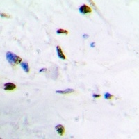 ZNF307 Rabbit Polyclonal Antibody